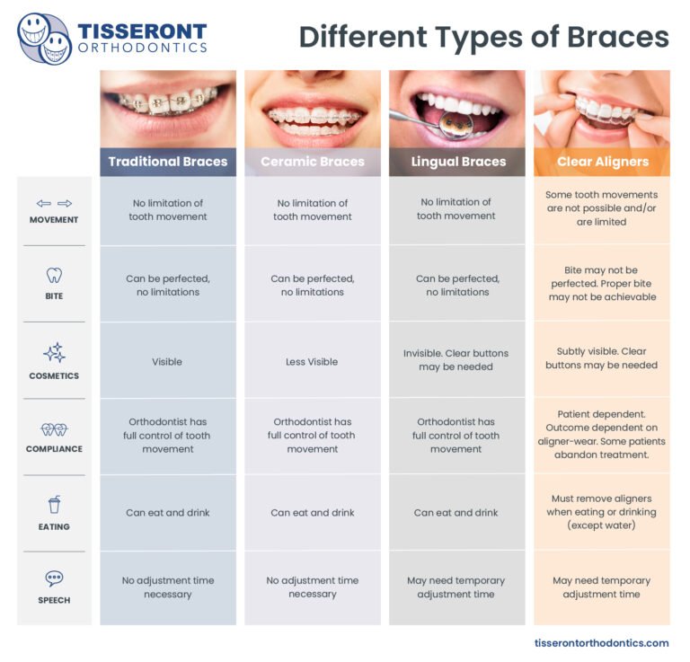 How Much is a down Payment for Braces With Insurance