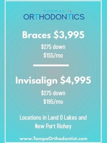 How Much is a down Payment on Braces